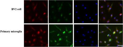 Ginsenoside Rg1 Exerts Anti-inflammatory Effects via G Protein-Coupled Estrogen Receptor in Lipopolysaccharide-Induced Microglia Activation